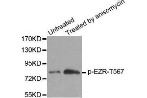 Western blot analysis of extracts from MDA cells, using Phospho-EZR-T567 antibody. (Ezrin 抗体  (pThr567))