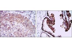 Immunohistochemistry (IHC) image for anti-Hyaluronan Synthase 3 (HAS3) antibody (ABIN1107625)