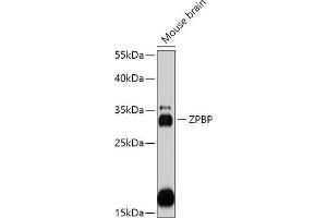 Western blot analysis of extracts of Mouse brain, using ZPBP antibody (ABIN7271569) at 1:1000 dilution. (ZPBP 抗体  (AA 45-200))