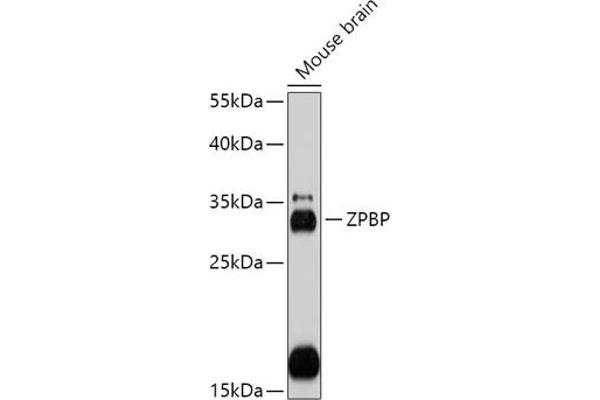 ZPBP antibody  (AA 45-200)