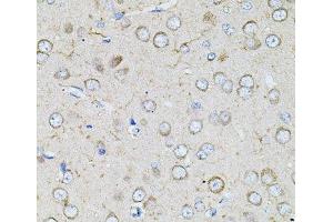 Immunohistochemistry of paraffin-embedded Rat brain using BEST1 Polyclonal Antibody at dilution of 1:100 (40x lens). (Bestrophin 1 抗体)