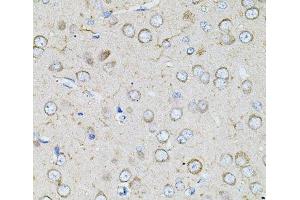 Immunohistochemistry of paraffin-embedded Rat brain using BEST1 Polyclonal Antibody at dilution of 1:100 (40x lens). (Bestrophin 1 抗体)