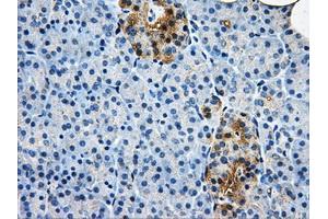 Immunohistochemical staining of paraffin-embedded liver tissue using anti-AKR1A1mouse monoclonal antibody. (AKR1A1 抗体)