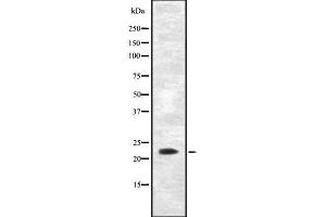 Western blot analysis of AK5 using Jurkat whole cell lysates (Adenylate Kinase 5 抗体  (N-Term))
