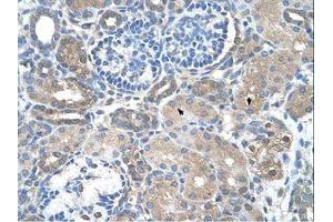 Image no. 1 for anti-Sarcosine Dehydrogenase (SARDH) (AA 94-143) antibody (ABIN320712) (SARDH 抗体  (AA 94-143))