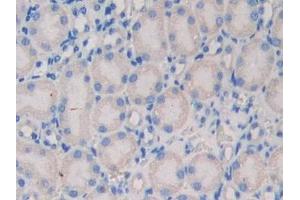 Detection of NEXN in Mouse Kidney Tissue using Polyclonal Antibody to Nexilin (NEXN) (NEXN 抗体  (AA 421-607))