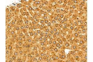 ABIN6258287 and ABIN6275230 at 1/100 staining Rat liver tissue by IHC-P. (MGST2 抗体  (Internal Region))