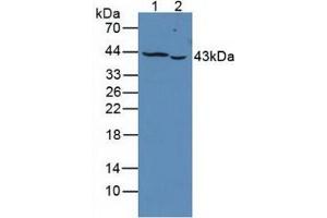 Western blot analysis of (1) Human K562 Cells and (2) Human Jurkat Cells. (PTPRJ 抗体  (AA 1061-1293))