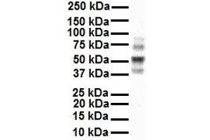 WB Suggested Anti-Ccnd1 antibody Titration: 1 ug/mL Sample Type: Human MCF7 (Cyclin D1 抗体  (C-Term))
