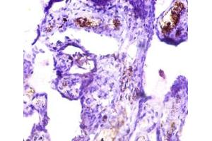 Immunohistochemistry of paraffin-embedded human placenta tissue using ABIN7157091 at dilution of 1:50 (ICA1 抗体  (AA 1-268))