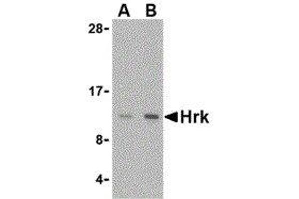 HRK anticorps  (Center)