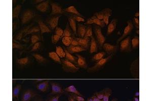 Immunofluorescence analysis of U-2 OS cells using CNBP Polyclonal Antibody at dilution of 1:100. (CNBP 抗体)