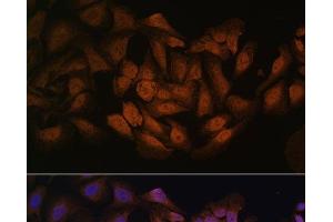 Immunofluorescence (IF) image for anti-CCHC-Type Zinc Finger, Nucleic Acid Binding Protein (CNBP) antibody (ABIN7258382)