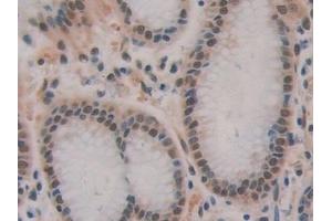 Immunohistochemistry (IHC) image for anti-Breast Carcinoma Amplified Sequence 3 (BCAS3) (AA 230-546) antibody (ABIN7443374)