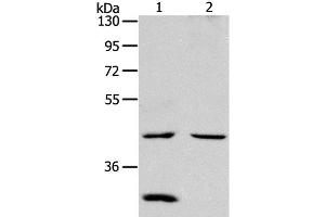Western Blot analysis of Mouse kidney and heart tissue using NCEH1 Polyclonal Antibody at dilution of 1:1300 (NCEH1 抗体)