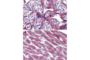 Immunohistochemical staining of formalin-fixed, paraffin-embedded human placenta (A) and human heart (B) tissue after heat-induced antigen retrieval. (ADCYAP1R1 抗体  (Extracellular Domain))