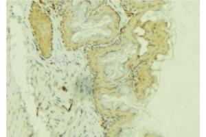 ABIN6274083 at 1/100 staining Mouse colon tissue by IHC-P. (PDLIM1 抗体  (Internal Region))