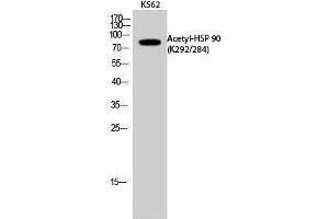 Western Blotting (WB) image for anti-Heat Shock Protein 90 (HSP90) (acLys284), (acLys292) antibody (ABIN6285474) (HSP90 抗体  (acLys284, acLys292))