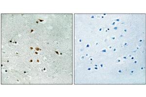 Immunohistochemical analysis of paraffin-embedded human brain tissue using FER (Phospho-Tyr402) antibody (left)or the same antibody preincubated with blocking peptide (right). (FER 抗体  (pTyr402))