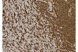 ABIN6277516 at 1/100 staining Human gastric tissue by IHC-P. (NDRG2 抗体  (C-Term))