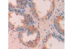 IHC-P analysis of prostate gland tissue, with DAB staining. (CA13 抗体  (AA 1-262))