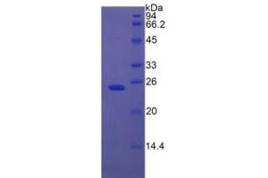 SDS-PAGE analysis of Rat Insulin Like Growth Factor Binding Protein 7 (IGFBP7) Protein. (IGFBP7 蛋白)