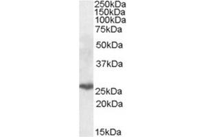 AP23684PU-N PSMB10 Antibody (0. (PSMB10 抗体  (Internal Region))