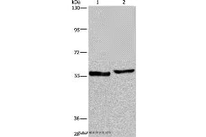 Western blot analysis of Human testis tissue and A375 cell, using SLC1A6 Polyclonal Antibody at dilution of 1:400 (SLC1A6 抗体)