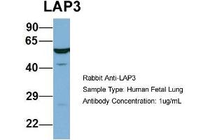 Host: Rabbit  Target Name: LAP3  Sample Tissue: Human Fetal Lung  Antibody Dilution: 1. (LAP3 抗体  (N-Term))