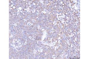 IHC analysis of PLCG 2/PLCG2 using anti-PLCG 2/PLCG2 antibody (ABIN5692854). (Phospholipase C gamma 2 抗体  (AA 1201-1258))