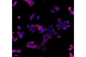 Immunocytochemistry (ICC) image for anti-Cytochrome C Oxidase Subunit Vb (COX5B) antibody (ABIN7073665)