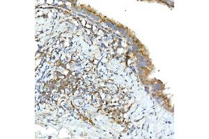 Immunohistochemistry of paraffin-embedded rat lung using TNF Rabbit pAb (ABIN3022984, ABIN3022985, ABIN3022986 and ABIN6219332) at dilution of 1:50 (40x lens). (TNFAIP3 抗体  (AA 1-190))