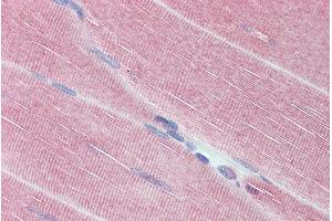 Immunohistochemistry (IHC) image for anti-Myosin Phosphatase, Target Subunit 1 (PPP1R12A) (C-Term) antibody (ABIN6391349)