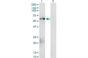 Western Blotting (WB) image for anti-SMAD, Mothers Against DPP Homolog 1 (SMAD1) (AA 1-110) antibody (ABIN561713)