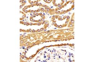 Immunohistochemical analysis of paraffin-embedded H. (BCAP31 抗体  (AA 120-147))