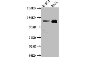 Western Blot Positive WB detected in: K562 whole cell lysate, Hela whole cell lysate All lanes: NUP98 antibody at 1:1000 Secondary Goat polyclonal to rabbit IgG at 1/50000 dilution Predicted band size: 198, 188, 98, 97, 196, 187 kDa Observed band size: 100 kDa (Recombinant NUP98 抗体)
