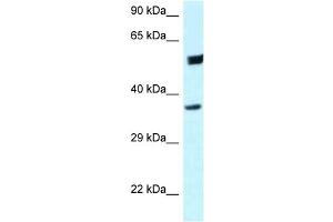 WB Suggested Anti-HOMER3 Antibody Titration: 1. (HOMER3 抗体  (C-Term))