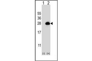 Western blot analysis of RAB3B (arrow) using RAB3B Antibody (C-term) Cat. (RAB3B 抗体  (C-Term))