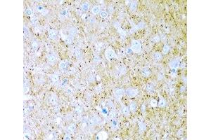 Immunohistochemistry of paraffin-embedded Rat brain using WNT2 Polyclonal Antibody at dilution of 1:200 (40x lens). (WNT2 抗体)
