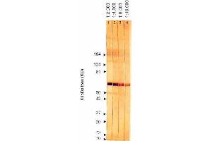 Western Blotting (WB) image for anti-Cytomegalovirus p65 (CMV p65) antibody (ABIN265537) (CMV p65 抗体)