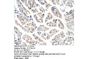 Rabbit Anti-ACO1 Antibody  Paraffin Embedded Tissue: Human Muscle Cellular Data: Skeletal muscle cells Antibody Concentration: 4. (Aconitase 1 抗体  (N-Term))