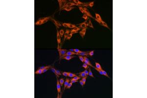Immunofluorescence analysis of PC-12 cells using DBI Rabbit pAb (ABIN6127407, ABIN6139420, ABIN6139422 and ABIN6217234) at dilution of 1:100 (40x lens).
