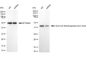 Western blotting analysis using Acyl-CoA dehydrogenase short chain antibody (ABIN7797493). (Recombinant Acyl Co-A Dehydrogenase (AIDB) (chain short) 抗体)