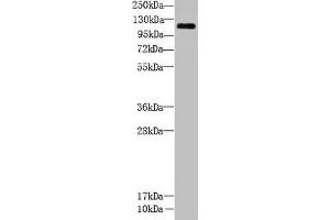 Western Blot All lanes: CCDC103 antibody at 5 μg/mL + Mouse heart tissue Secondary Goat polyclonal to rabbit IgG at 1/10000 dilution Predicted band size: 28, 12 kDa Observed band size: 111 kDa (CCDC13 抗体  (AA 1-242))