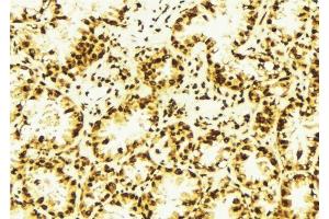 ABIN6277741 at 1/100 staining Human lung tissue by IHC-P. (ASH2L 抗体  (Internal Region))