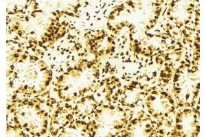 ABIN6277741 at 1/100 staining Human lung tissue by IHC-P.