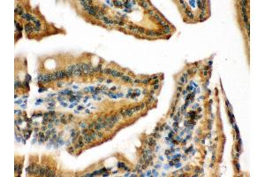 Anti- RAB13 Picoband antibody, IHC(P) IHC(P): Mouse Intestine Tissue (RAB13 抗体  (C-Term))