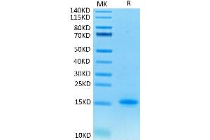 Cynomolgus CD3E on Tris-Bis PAGE under reduced condition. (CD3 epsilon Protein (CD3E) (His tag))