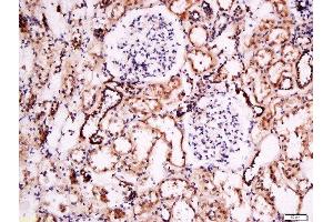 Formalin-fixed and paraffin embedded human kidney labeled with Anti- Pan FOXD Polyclonal Antibody, Unconjugated  at 1:200 followed by conjugation to the secondary antibody and DAB staining. (FOXD (AA 131-230) 抗体)