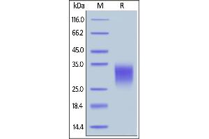 Human IL-22, His Tag on  under reducing (R) condition. (IL-22 Protein (AA 34-179) (His tag))